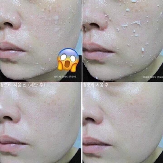 Kem tẩy tế bào chết dạng gel dành cho mặt và body(arahan) | BigBuy360 - bigbuy360.vn