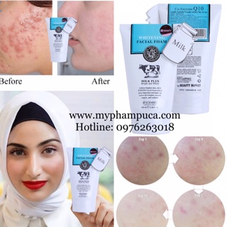 Sữa Rửa Mặt Trắng Da Ngừa Mụn Con Bò Milk Plus Whitening Q10 Facial Foam 100ml