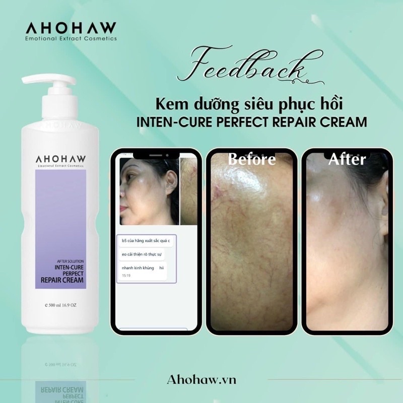 Kem phục hồi da B5 Ahohaw - Perfect Repair Cream