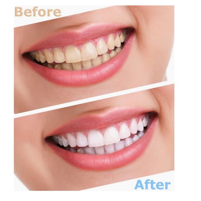 Kem Đánh Răng Crest 3D White Advanced Triple Whitening