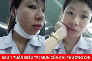 Serum dưỡng da Dew&Dew