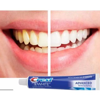 Kem Đánh Răng Crest 3D White Advanced 158gr