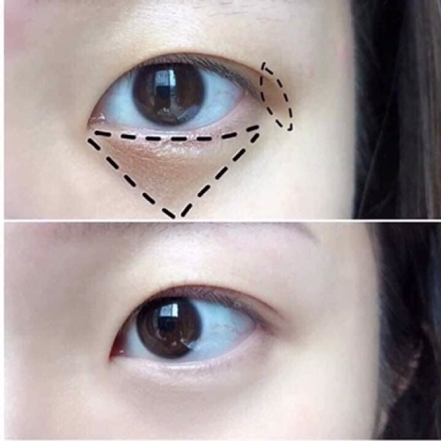 [Chính Hãng] KEM CHỮA THÂM MẮT MEISHOKU | BigBuy360 - bigbuy360.vn