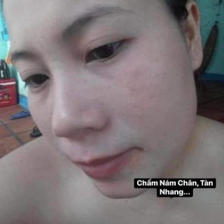 PEEL THAY DA MẶT TCA_USA