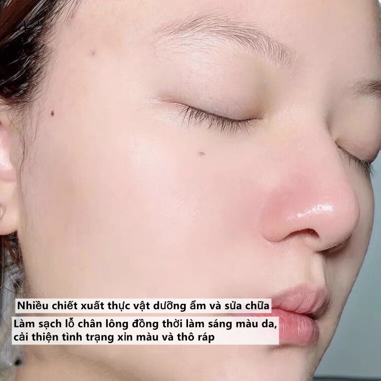 Gel Tẩy Tế Bào Chết Rnw Làm Sạch Sâu Loại Bỏ Mụn Đầu Đen Không Gây Kích Ứng Da