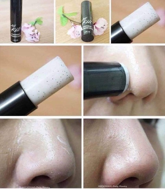 THANH TẨY MỤN ĐẦU ĐEN ALL KILL