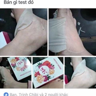 Thay da sinh học collagen