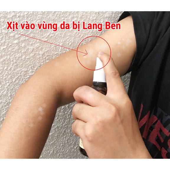 Hồng Sơn Xịt Nấm Lang Ben Hắc Lào