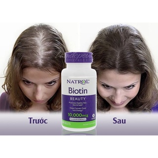 Viên uống mọc tóc móng, giảm gãy rụng Natrol Biotin maximum strength 10,000mcg 100 viên nội địa Mỹ Maxwell
