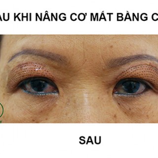 Máy nhấn mí PLASMA