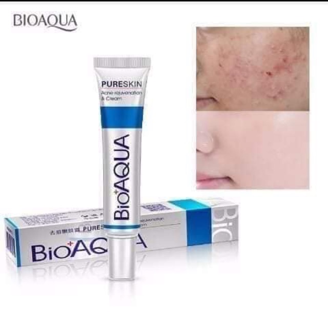 Kem mụn kiềm dầu Bioaqua Pure skin | BigBuy360 - bigbuy360.vn