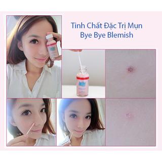 [Quinshop.vn] Lotion Làm Xẹp Mụn Sưng Cấp Tốc Bye Bye Blemish Drying Lotion