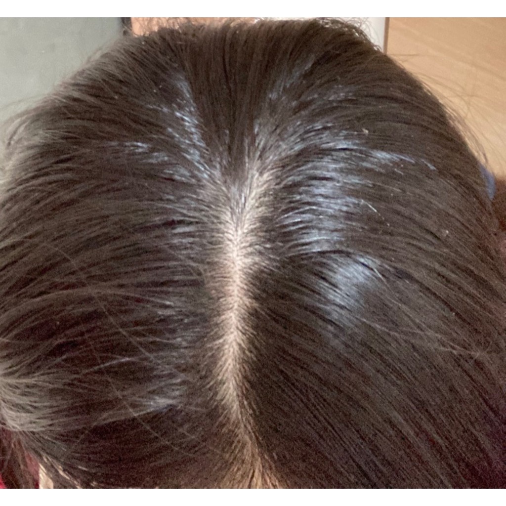 Xịt dưỡng tóc và da đầu ngăn rụng tóc, gàu, nấm Dr. BanggiWon Lab Hair Tonic 150ml