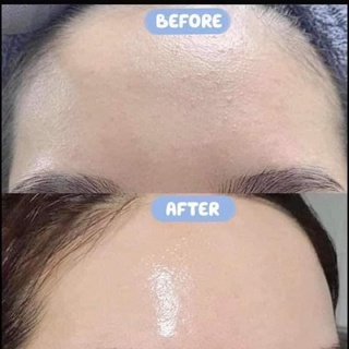 Serum SMAS HA 100ml