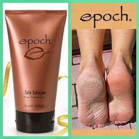 KEM NỨT GÓT CHÂN - EPOCH SOLE SOLUTION FOOT 125ML