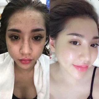 Ủ TRẮNG KÉN TẰM