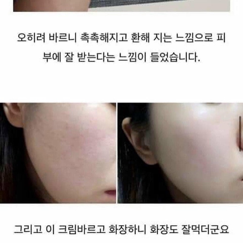 [HSD 24] Kem dưỡng phục hồi làm dịu da B5 Cica Treatment Repair Daily Cream Wellderma Hàn Quốc