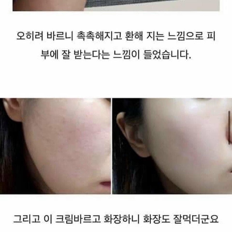Kem dưỡng phục hồi làm dịu da B5 Cica Treatment Repair Daily Cream Wellderma Hàn Quốc