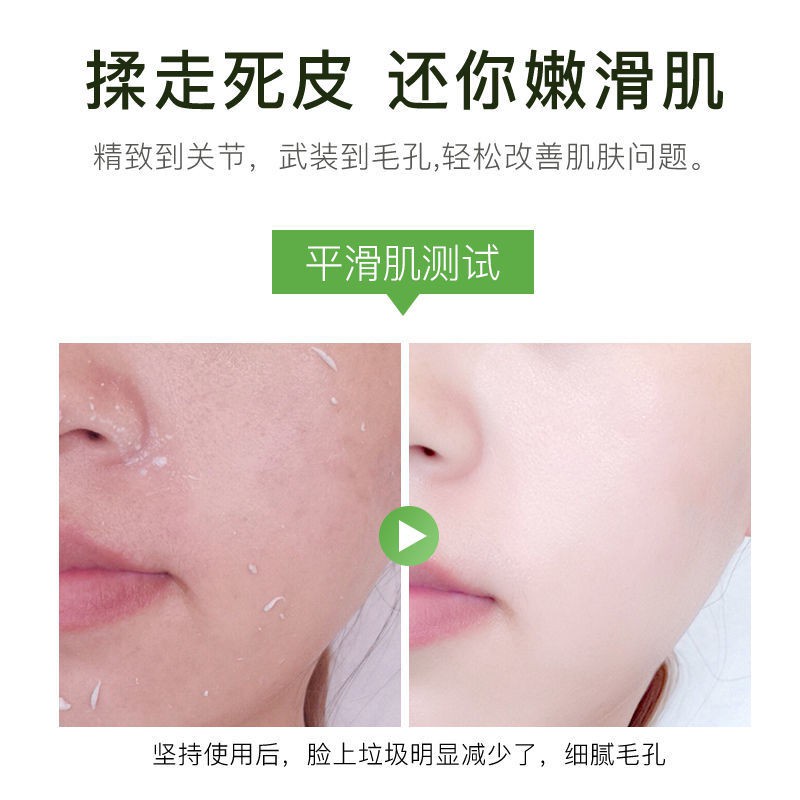 Iyu Aloe Exfoliating Gel Whitening Facial Women and Men Whitening Goose Skin Dead Skin Blackheads Rubbing Mud Treasure Scrub Cream