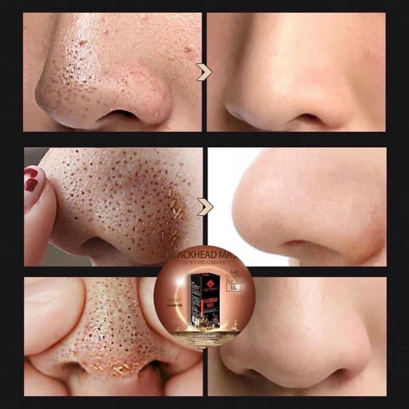 {Có kèm giấy lột}  ủ mụn đầu đen Blackhead mask 18ml | BigBuy360 - bigbuy360.vn