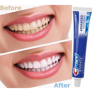 Kem Đánh Răng Crest 3D White Advanced Whitening 158g