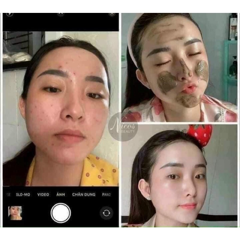 [Chính hãng] SỮA RỬA MẶT ĐÔNG Y NICOS