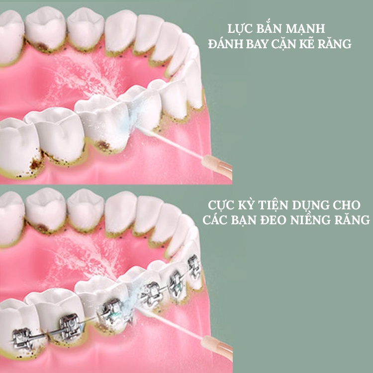 Tăm Nước, Máy Tăm Nước Cầm Tay Oral Irrigator chống nước - Tặng 4 Vòi Vệ Sinh Răng Hiệu Quả Hơn