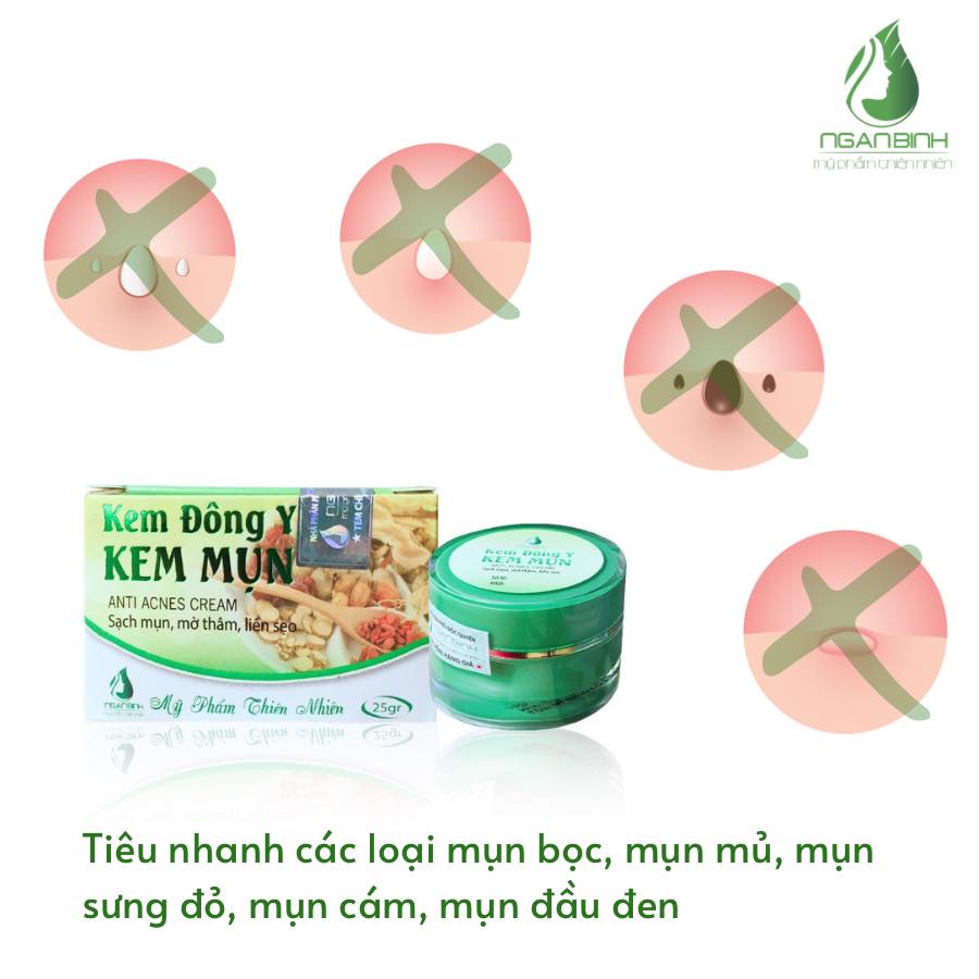 Kem mụn đông y Ngân Bình 25gr