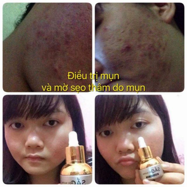 Serum sắc mộc nương thần thánh nhà em. Ngoài tác dụng làm hồng mọi chỗ, còn có những tác dụng thần thánh lắm ah🌹🌹🌹🌹