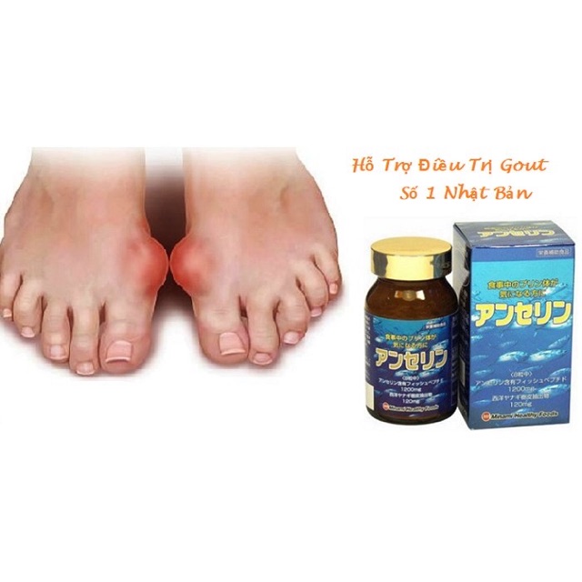 Viên uống trị gout Nhật Bản