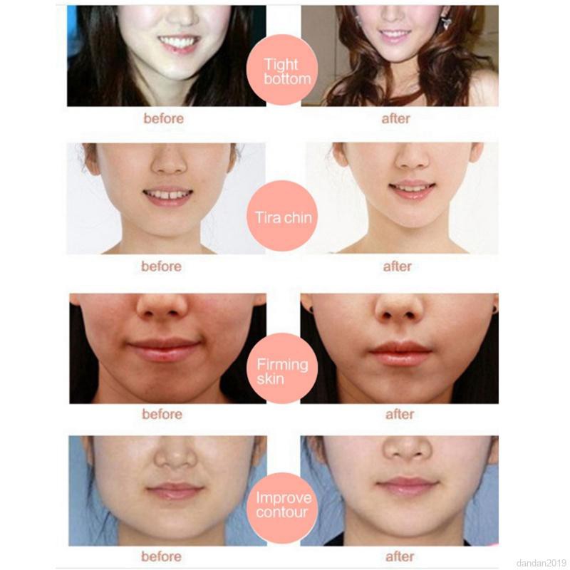 Mặt nạ gel có dây móc tai định hình thon gọn gương mặt V-Line