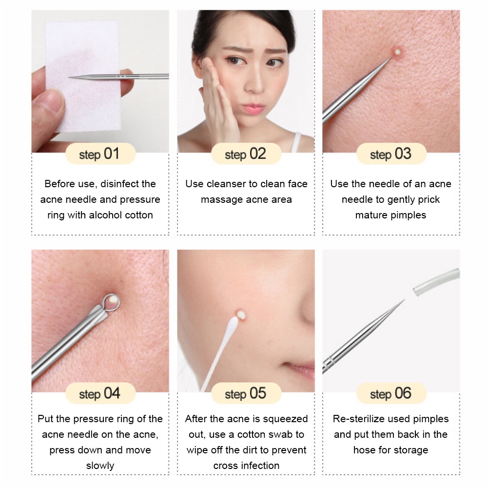 Bộ 4 dụng cụ nặn mụn đầu đen bằng thép không gỉ