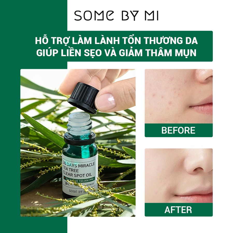 Tinh Dầu Tràm Trà Thần Kỳ Some By Mi 30 Days Miracle Tea Tree Clear Spot Oil 10ml