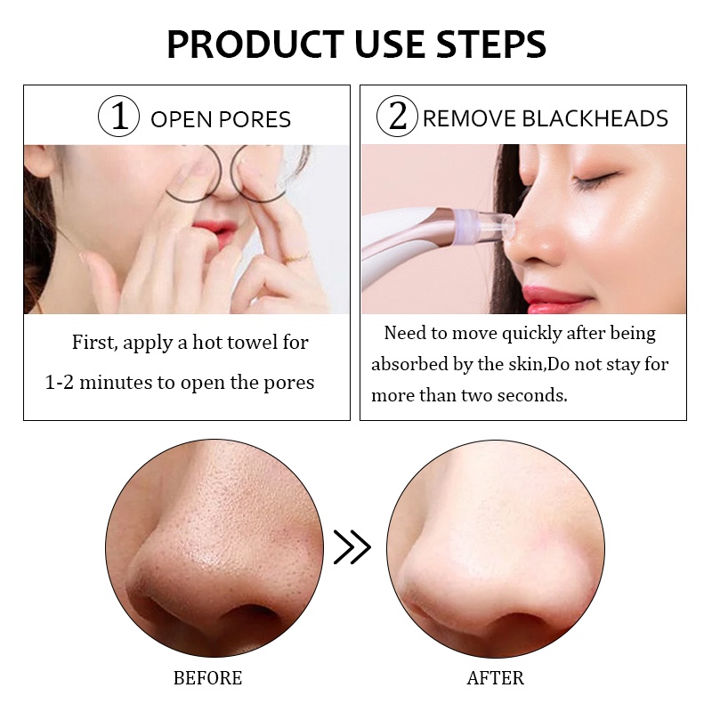 Máy hút mụn đầu đen SUAKE làm sạch lỗ chân lông chạy điện tiện dụng