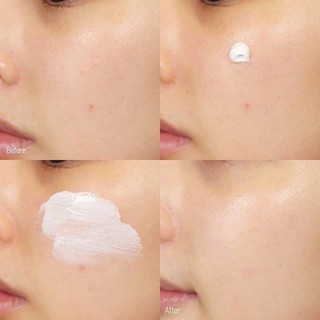 💦  𝐊𝐄𝐌 𝐃𝐔̛𝐎̛̃𝐍𝐆 𝐏𝐇𝐔̣𝐂 𝐇𝐎̂̀𝐈 𝐃𝐀 LA ROCHE-POSAY CICAPLAST BAUME B5 - Pháp  💦