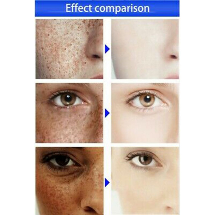 beautysecret kem dưỡng trắng da mặt chiết xuất thực vật loại bỏ tàn nhang 30g | BigBuy360 - bigbuy360.vn