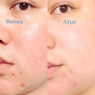 Sữa rửa mặt La Roche-Posay 50ml