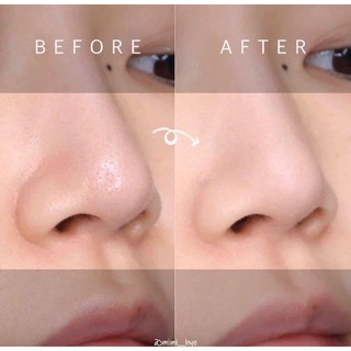 [ FREE SHIP] Thanh lăn mụn đầu đen red peel clear sitck