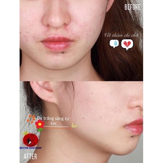 (Mẫu mới) Serum CC melano mờ thâm sáng da