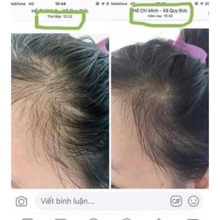 ♥️[Tặng Quà] LaGirl_Kích Thích Mọc Tóc♥️