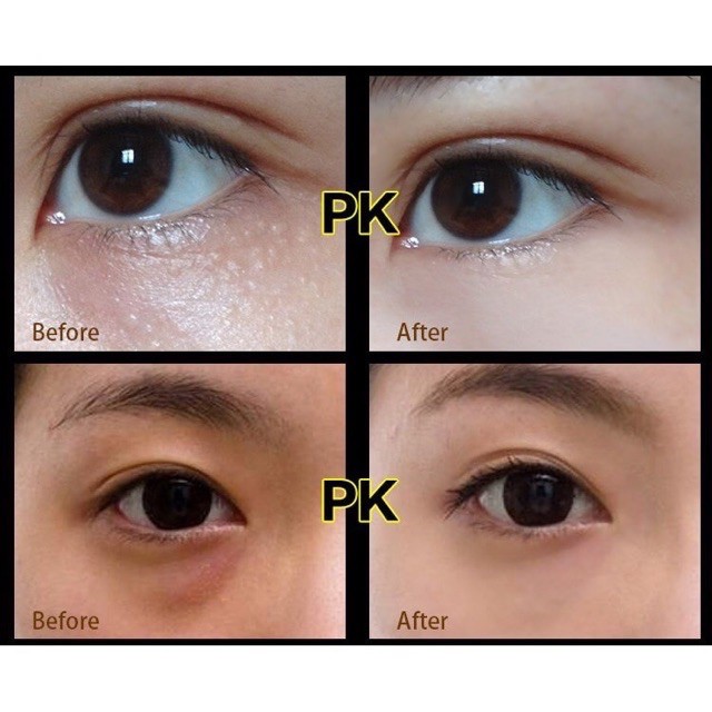 🌈🍓🍭 Kem Dưỡng Giảm Thâm Quầng, Tan Bọng Mắt, Kem Giảm Mụn Thịt Herbal Essence Eye Cream - Y307-D5T3 | BigBuy360 - bigbuy360.vn