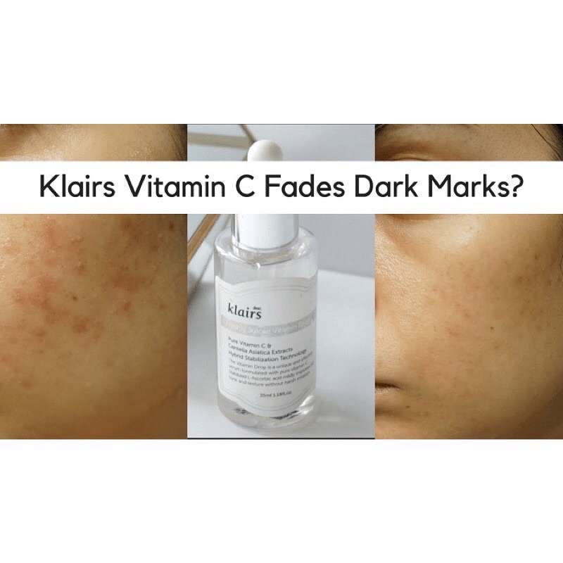 { HÀNG CÔNG TY}  Serum Vitamin C Klairs Freshly Juiced Dưỡng Sáng Trẻ Hóa Da 35ML