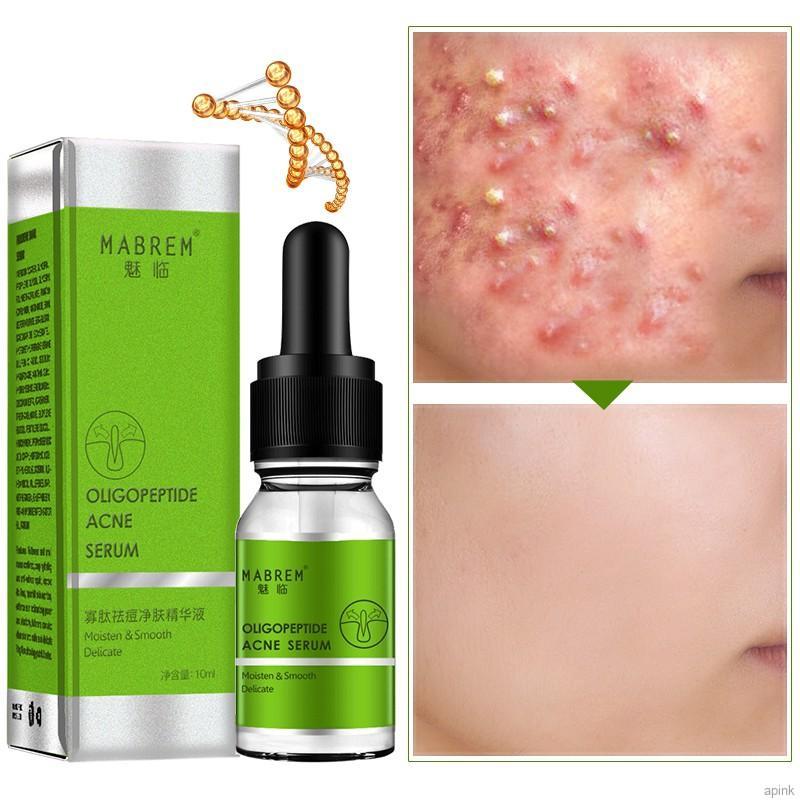 [Hàng mới về] Tinh Chất Oligopeptide Giảm Mụn Dưỡng Ẩm Làm Mịn Da Hiệu Quả