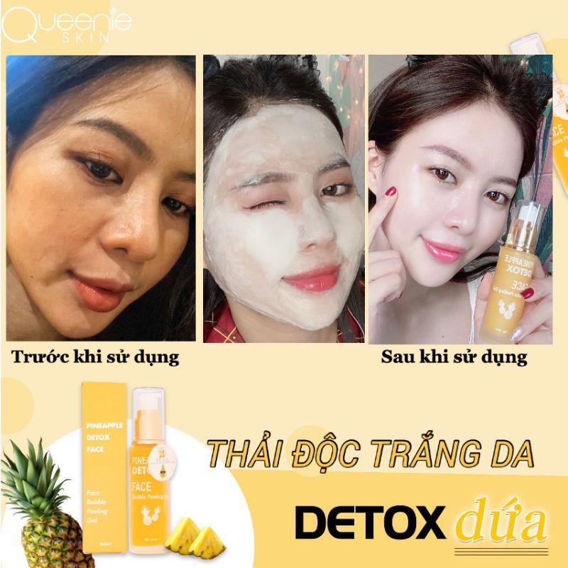 DETOX DỨA -THẢI ĐỘC DA MẶT QUEENIE SKIN