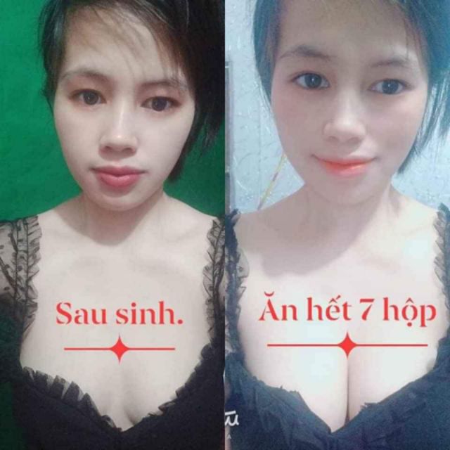 Tặng 01 cao nghệ sữa ong chua khi mua 10 hộp kẹo mầm gold | BigBuy360 - bigbuy360.vn