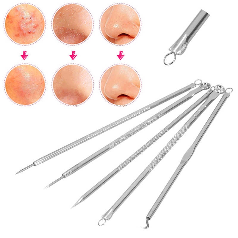 Bộ 5 Cây Nặn Mụn Bằng Thép Không Gỉ Tiện Dụng | BigBuy360 - bigbuy360.vn