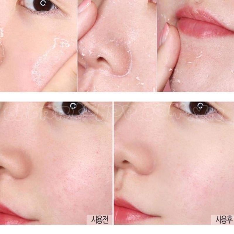Tẩy tế bào chết Missha Super Aqua D-tox Peeling Gel