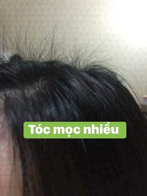 Tinh Dầu Bưởi Dưỡng Tóc Thuỷ Mộc Dạng Xịt Ngăn Rụng Tóc Kích Mọc Tóc Dài Dùng Được Cho Người Ít Tóc Hói Đầu | BigBuy360 - bigbuy360.vn