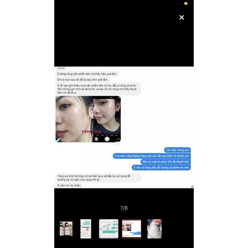 Serum làm lành vết sẹo lồi , sẹo lõm, sẹo rỗ nhanh chóng OfLe Nhật bản