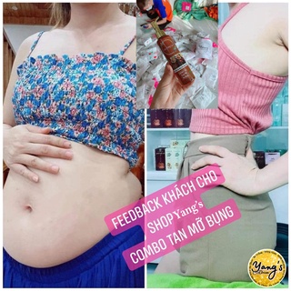 CAO GỪNG HỦY MỠ, CAO GỪNG XOA BÓP ĐÔNG Y GIẢM MỠ